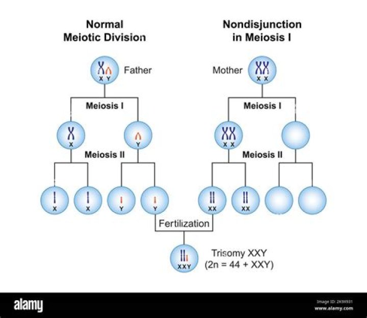 Charles Barkley And Klinefelter Syndrome: Understanding The Connection