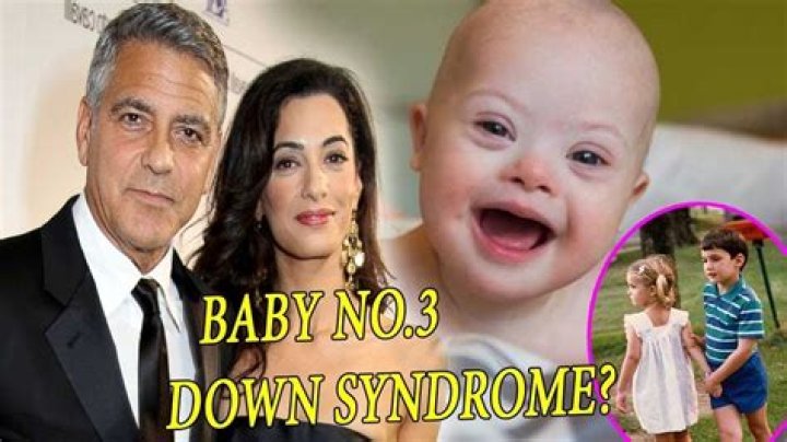 Exploring The Truth: Does George Clooney's Son Have Down Syndrome?