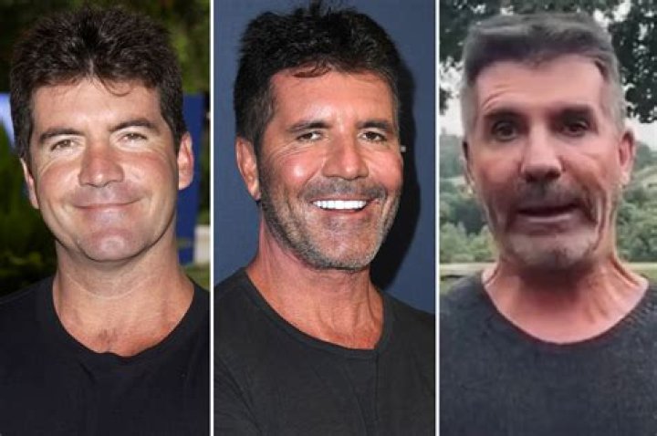 Has Simon Cowell Had A Stroke? His Illness And Health Update