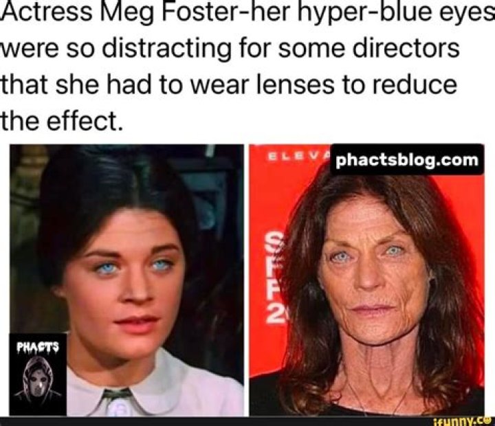 Is Something Wrong With Meg Foster Eyes? Mutation Or Genetic Defect