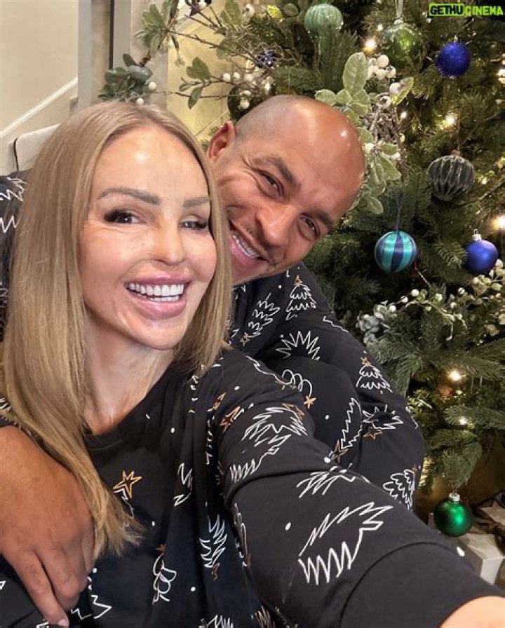 Katie Piper Wiki Bio Married Husband Wedding Now Net Worth, Acid Attack