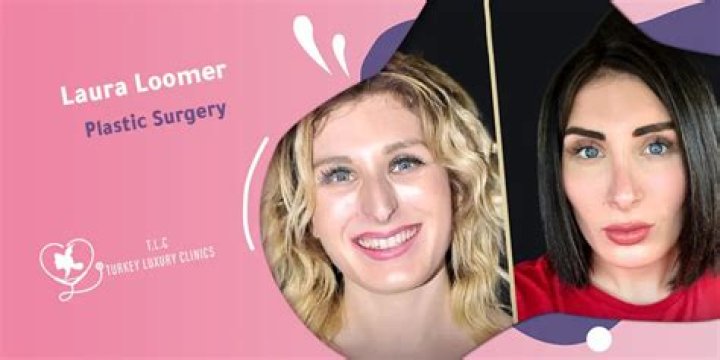 Laura Loomer’s Plastic Surgery: Is She Addicted To Cosmetic Surgery? Look at the Before and After Pictures!