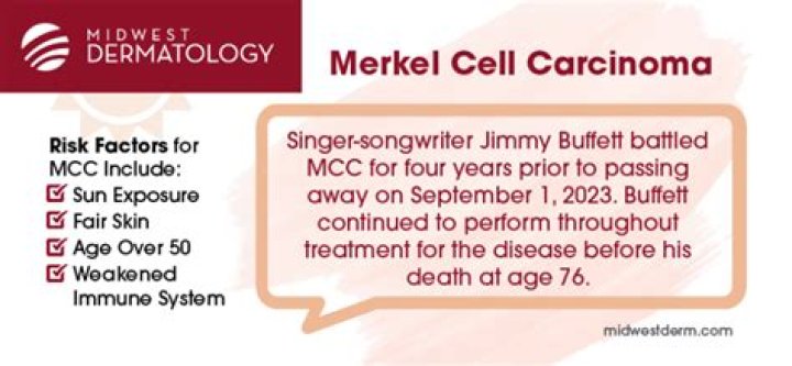 Merkel Cell Skin Cancer Jimmy Buffett, What To Know About The Skin Cancer - News