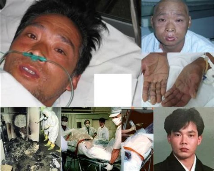 Surviving The Inferno: The 83 Days Of Hisashi Ouchi's Real Struggle