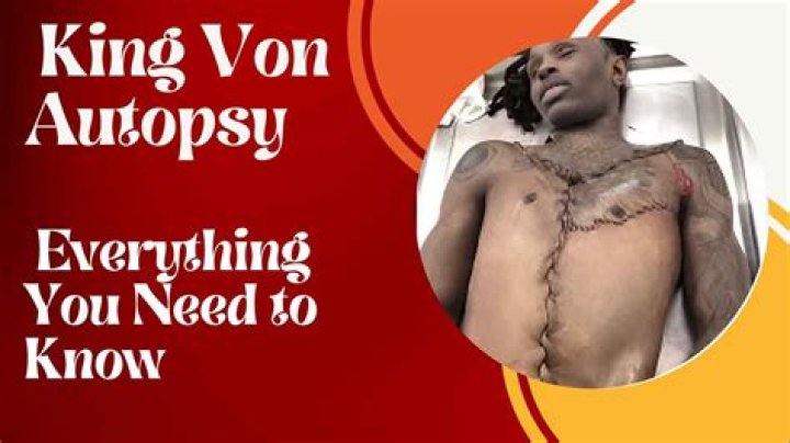 Unveiling The Truth: King Von's Autopsy Picture And Its Implications